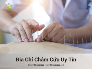 Địa chỉ châm cứu TPHCM