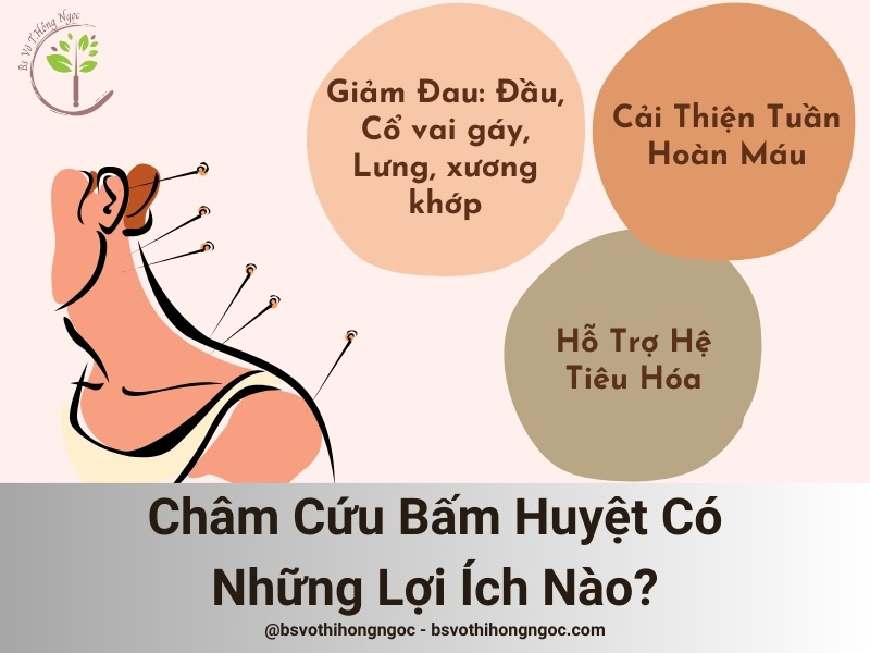 Châm Cứu Bấm Huyệt Có Những Lợi Ích Nào?